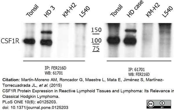 Anti Human CD115/CSF1R Antibody, clone FER216 gallery image 5