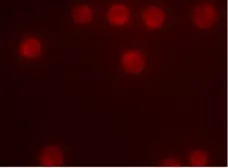 Magic Red™ Cathepsin B Kit gallery image 1