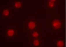 Magic Red™ Cathepsin L Kit gallery image 1
