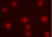 Magic Red™ Cathepsin L Kit thumbnail image 1