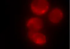 Magic Red™ Cathepsin L Kit gallery image 2
