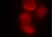 Magic Red™ Cathepsin L Kit thumbnail image 2