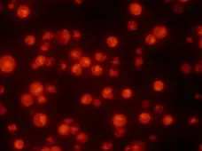 SR FLICA™ Poly Caspase Kit gallery image 1