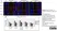 Anti 5-Methylcytidine Antibody, clone 33D3 thumbnail image 1