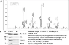 Anti ALIX Antibody, clone 3A9 gallery image 2
