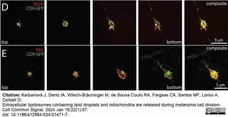 Anti ALIX Antibody, clone 3A9 gallery image 8