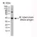 Anti Mycobacterium tuberculosis 38kDa Antigen Antibody, clone BGN/1209/3875 thumbnail image 1