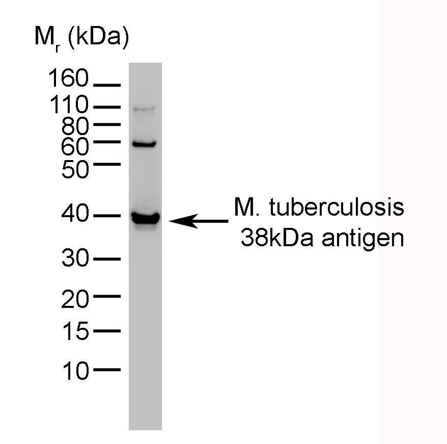 Anti Mycobacterium tuberculosis 38kDa Antigen Antibody, clone BGN/1209/3875 gallery image 1