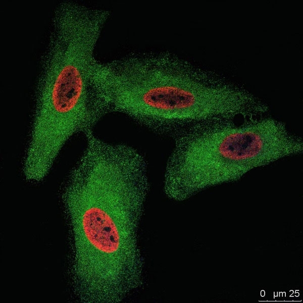 Anti BrdU Antibody, clone RF06 (Monoclonal Antibody Antibody) gallery image 2