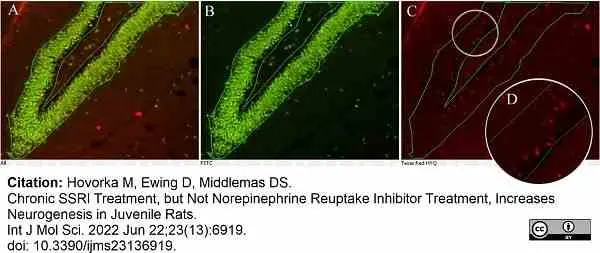 Anti BrdU Antibody, clone RF06 (Monoclonal Antibody Antibody) gallery image 4