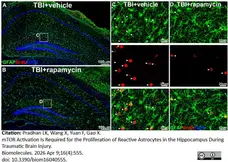 Anti BrdU Antibody, clone RF06 (Monoclonal Antibody Antibody) gallery image 8