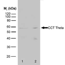 Anti CCT Theta Antibody, clone PK/13/72/8k gallery image 1