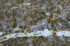 Anti Bovine CD1w2 Antibody, clone CC20 gallery image 1
