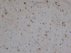 Anti Bovine GFAP Antibody, clone 1B4 gallery image 1