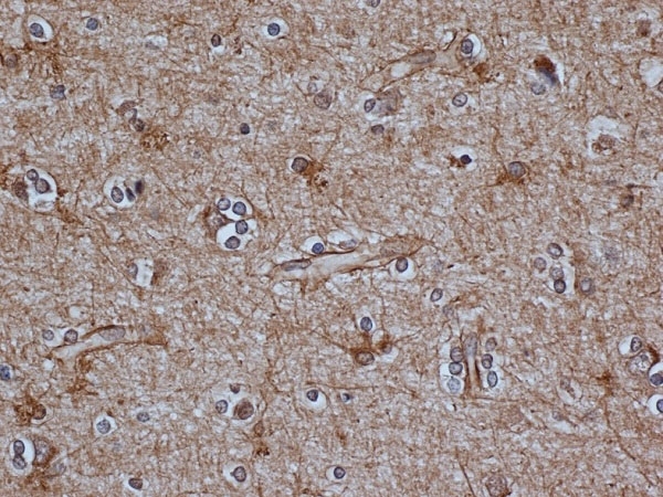 Anti Bovine GFAP Antibody, clone 2E1 gallery image 1