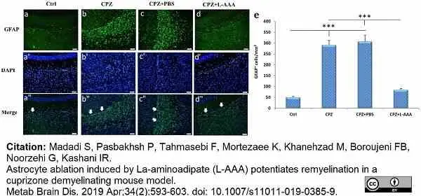 Anti Bovine GFAP Antibody, clone 2E1 gallery image 2