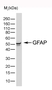 Anti Bovine GFAP Antibody, clone 4A11 thumbnail image 1
