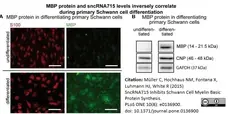 Anti MBP (aa82-87) Antibody, clone 12 gallery image 10
