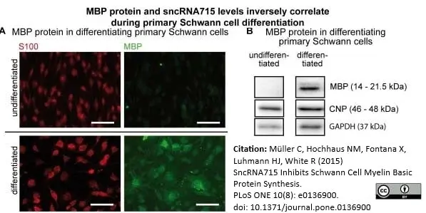 Anti MBP (aa82-87) Antibody, clone 12 gallery image 10
