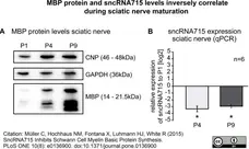 Anti MBP (aa82-87) Antibody, clone 12 gallery image 11