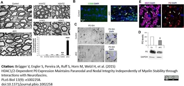 Anti MBP (aa82-87) Antibody, clone 12 gallery image 13