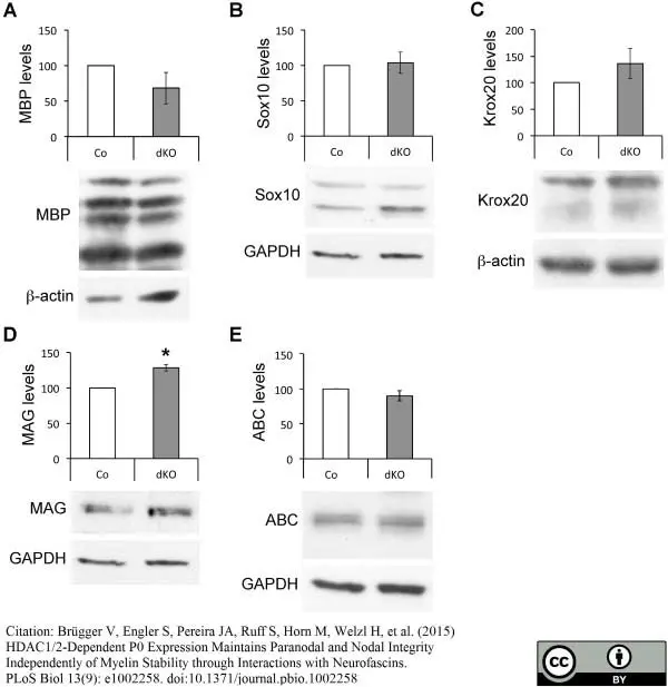 Anti MBP (aa82-87) Antibody, clone 12 gallery image 17