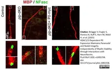 Anti MBP (aa82-87) Antibody, clone 12 gallery image 18