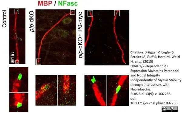 Anti MBP (aa82-87) Antibody, clone 12 gallery image 18