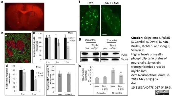Anti MBP (aa82-87) Antibody, clone 12 gallery image 21