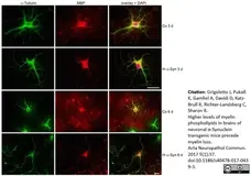 Anti MBP (aa82-87) Antibody, clone 12 gallery image 23
