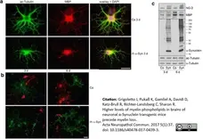 Anti MBP (aa82-87) Antibody, clone 12 gallery image 24