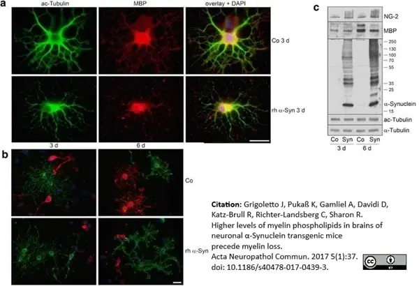 Anti MBP (aa82-87) Antibody, clone 12 gallery image 24