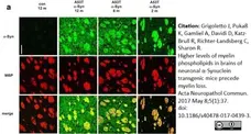 Anti MBP (aa82-87) Antibody, clone 12 gallery image 25