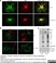 Anti MBP (aa82-87) Antibody, clone 12 thumbnail image 24