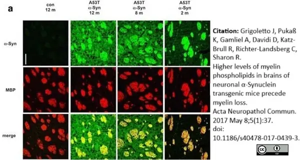 Anti MBP (aa82-87) Antibody, clone 12 gallery image 25