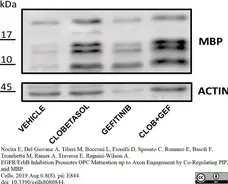 Anti MBP (aa82-87) Antibody, clone 12 gallery image 29
