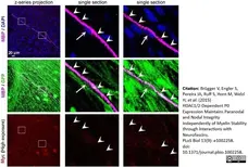 Anti MBP (aa82-87) Antibody, clone 12 gallery image 31