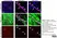 Anti MBP (aa82-87) Antibody, clone 12 thumbnail image 31
