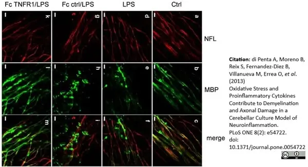 Anti MBP (aa82-87) Antibody, clone 12 gallery image 38