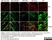 Anti MBP (aa82-87) Antibody, clone 12 thumbnail image 38