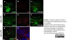 Anti MBP (aa82-87) Antibody, clone 12 gallery image 40