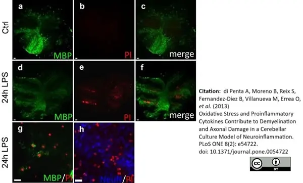 Anti MBP (aa82-87) Antibody, clone 12 gallery image 40