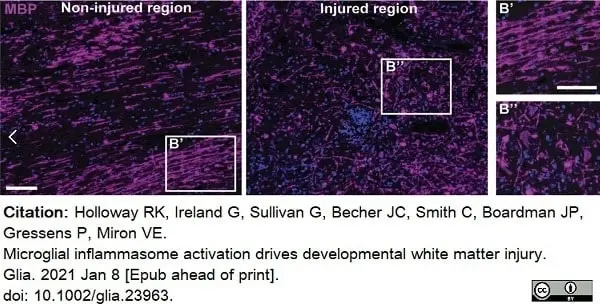 Anti MBP (aa82-87) Antibody, clone 12 gallery image 44