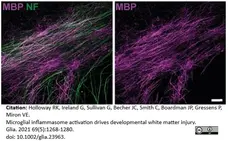 Anti MBP (aa82-87) Antibody, clone 12 gallery image 45