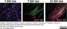 Anti MBP (aa82-87) Antibody, clone 12 gallery image 46