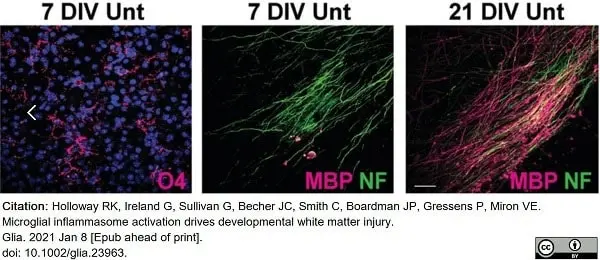 Anti MBP (aa82-87) Antibody, clone 12 gallery image 46