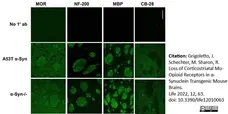 Anti MBP (aa82-87) Antibody, clone 12 gallery image 53