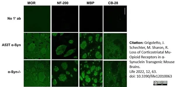 Anti MBP (aa82-87) Antibody, clone 12 gallery image 53