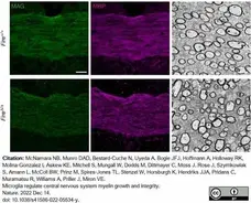Anti MBP (aa82-87) Antibody, clone 12 gallery image 54