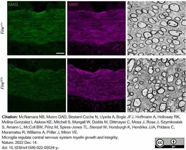 Anti MBP (aa82-87) Antibody, clone 12 gallery image 54